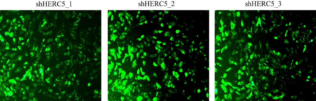 Lentiviral transduction efficiency in EA.hy926 cells. (A) Representative fluorescence micrographs of EGFP-positive cells 72 h after transduction with shHERC5_1, shHERC5_2, and sh HERC5_3 (scale bar = 100 µm). (B) Quantitative transduction efficiency calculated as the percentage of EGFP-positive cells relative to total cells in three randomly selected fields per construct. Data are presented as mean ± SD (n = 3). Untransduced (Mock) and shNC controls were included in all subsequent experiments.